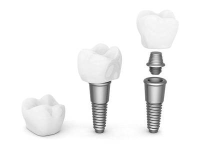 Fotolia_55501277_XS